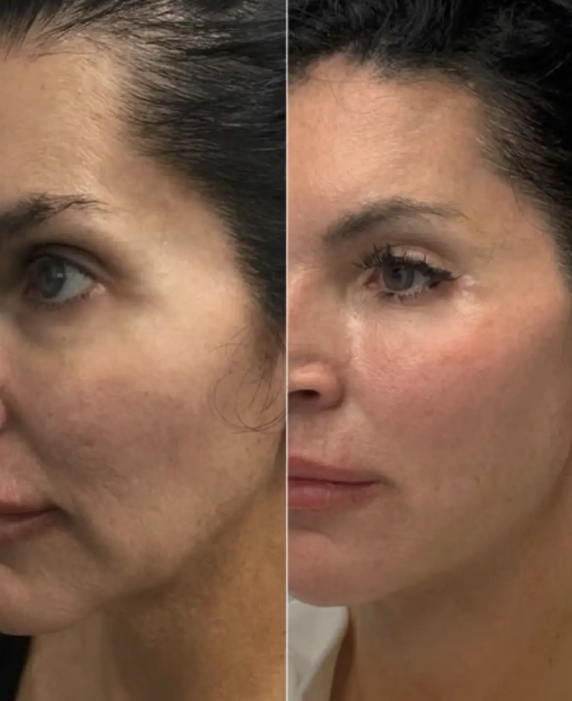 does face sculpting work